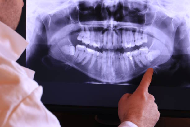 Best 24-Hour Emergency Dentist in Chilhowie, VA