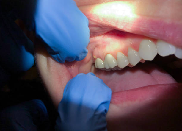 Best Orthodontic Emergency Dentist in Chilhowie, VA